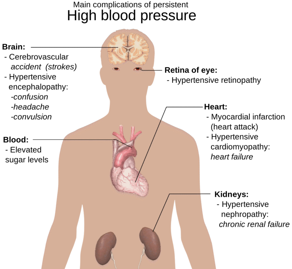 human body anatomy, overview, hypertension-1279987.jpg