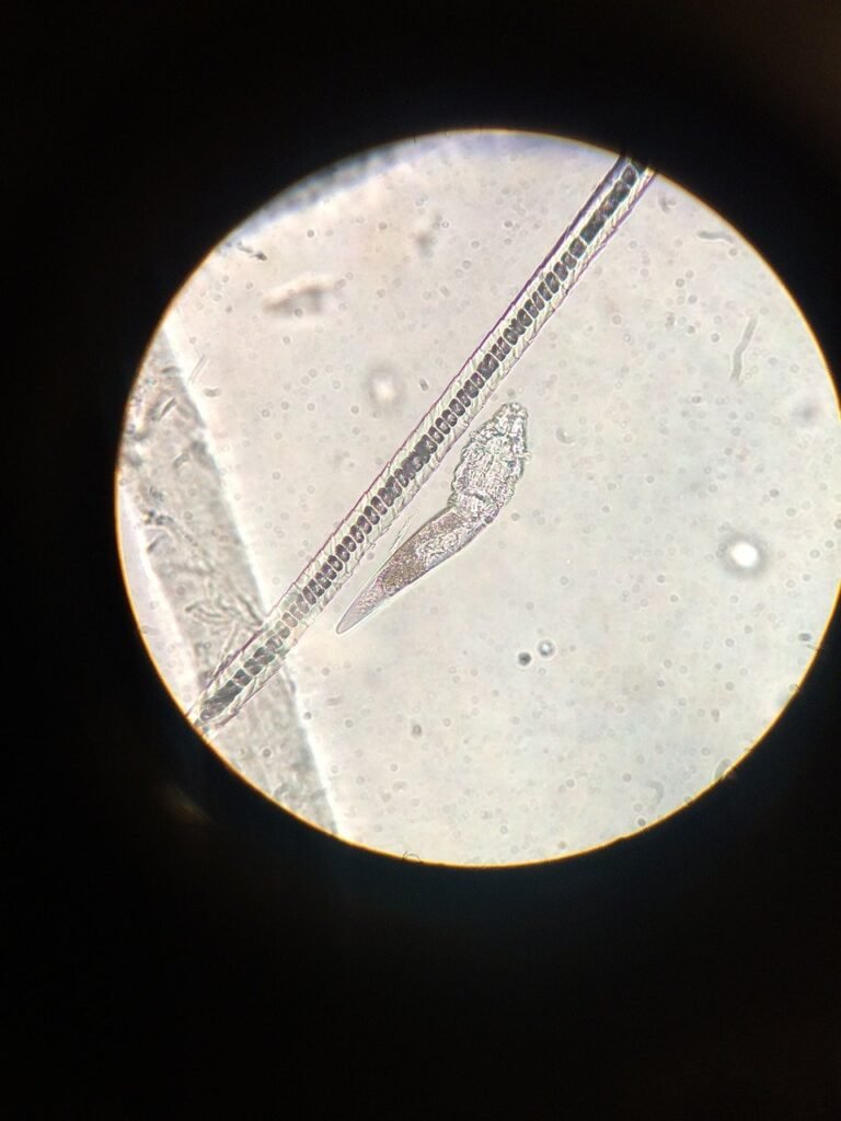 microscope, midd, hair follicle mite-1168472.jpg
